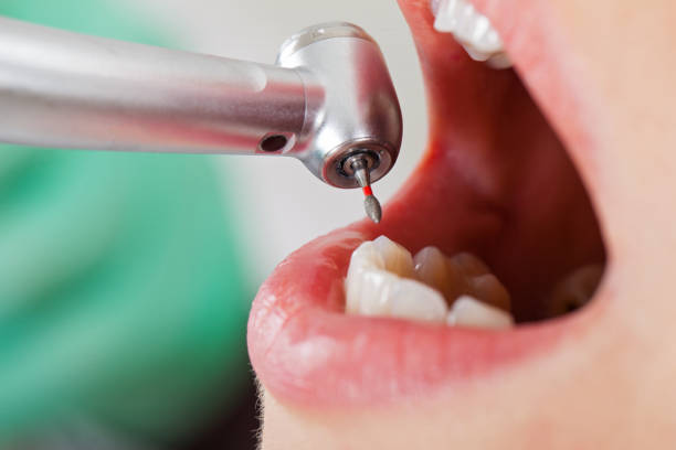 Best Dental Abscess Treatment in Bayou Vista, TX